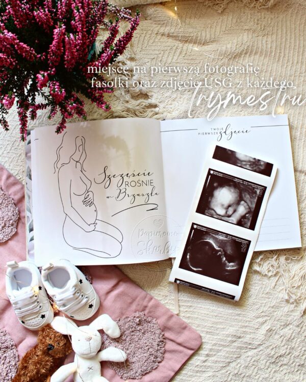 karta albumu ciążowego od brzuszka do maluszka- Twoje pierwsze zdjęcie z miejscem na fotografię USG